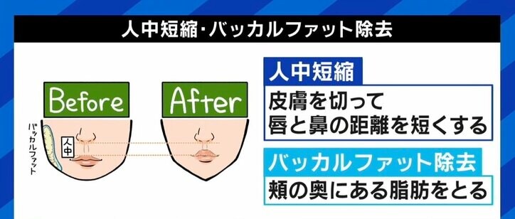 「“加工の顔にしたい”の希望が多い」 写真アプリを現実に？ 17歳少女の整形手術を断った美容外科医が“SNSの闇”に訴え