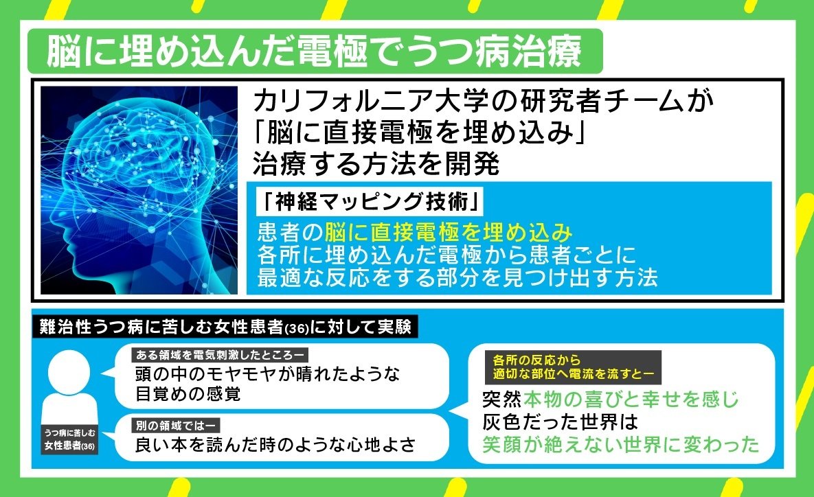 脳に直接埋め込んだ電極で うつ病改善 の試験結果 安全性が確認されれば 日常 に 国際 Abema Times