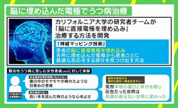 脳に直接埋め込んだ電極で“うつ病改善”の試験結果 安全性が確認されれば“日常”に？