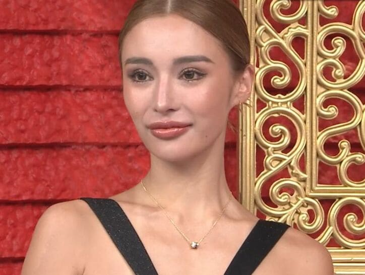 【写真・画像】“北のブラックダイヤモンド”褐色美肌キャバ嬢がダウンタイムの辛さを告白「泣きました」　1枚目