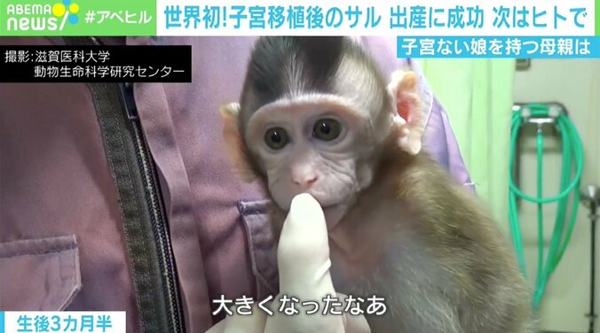 「娘に子宮をあげたい」母親の思い 世界初サルの子宮移植後の出産成功で見えた光 1枚目