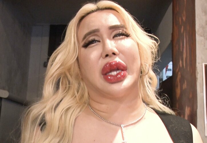 【写真・画像】アレン様、“富の象徴”を公開「我慢して死んでいくのは絶対ヤダ」　1枚目