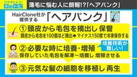 けやきヒルズ - ネットピ - 薄毛を悩む人に朗報!? 将来の髪への保険“ヘアバンク”が間もなく運用! (19/03/04) | 動画視聴は【Abemaビデオ(AbemaTV)】