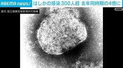 はしかの感染300人超 去年同時期の4倍に