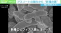 アスリートの便は茶色のダイヤ!? 腸内から“新種の菌”発見 感染症予防や健康維持に注目集まる
