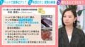 お尻から“白い塊”排出…黄色いツブツブは全て「ダニ」1平米あたり10万匹以上?あなたの布団でも起きているかもしれない深刻な実態