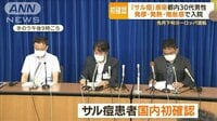 日本で初確認…米国の感染男性語る症状「1日で30カ所斑点」「全身に痛み」
