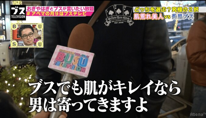 肌荒れ美人VS美肌ブス　男性ウケがいいのは？ 1枚目