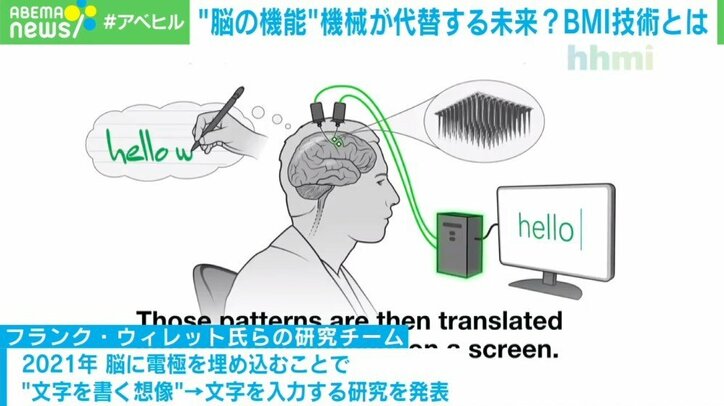 きちんと発語できなくても”脳波で文字入力”が可能に 期待高まる「BMI技術」とは