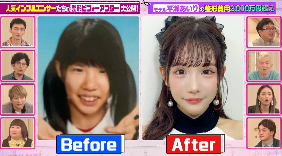 整形 モデル