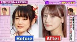 顔全パーツ整形の福岡みなみ、ビフォーの顔に美容外科医が本音ポロリ