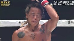 OFGマッチ、不運のアクシデントでドクターストップ 悔し涙の勝者に「いい試合だった」「視力に影響なければ」称賛と心配の声 