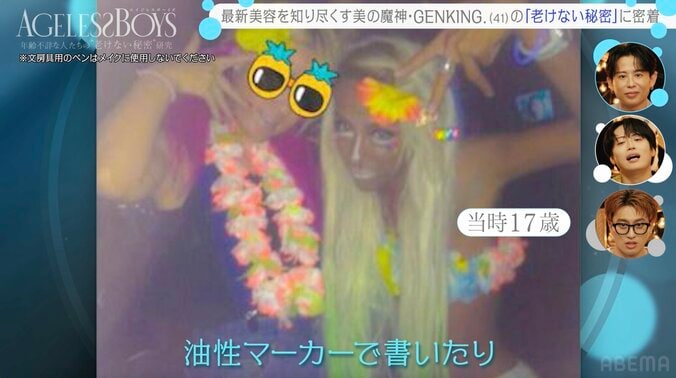41歳タレント、衝撃のヒアルロン酸注入の施術光景を公開「私が初じゃね？」 4枚目