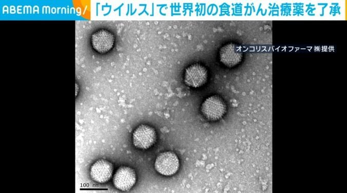 ウイルス