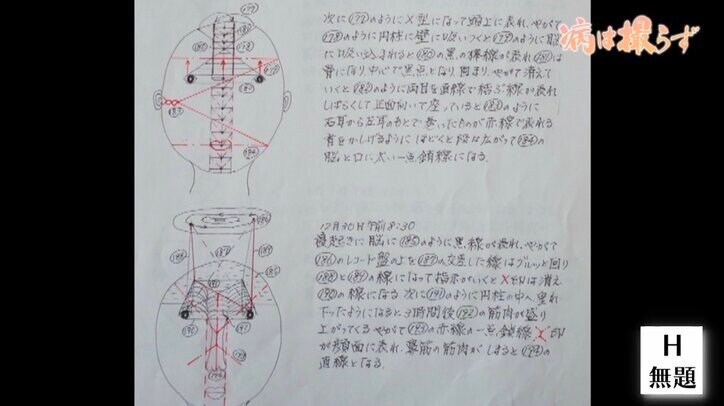 「現実を表に出さないといけない」全国の病院をめぐり、精神疾患の入院者を撮り続ける写真家