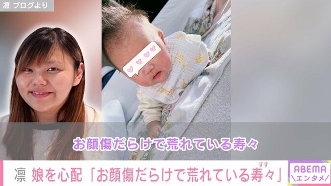 北斗晶の義娘・凛「お顔傷だらけで荒れている寿々」娘の最新ショットに心配の声 1枚目