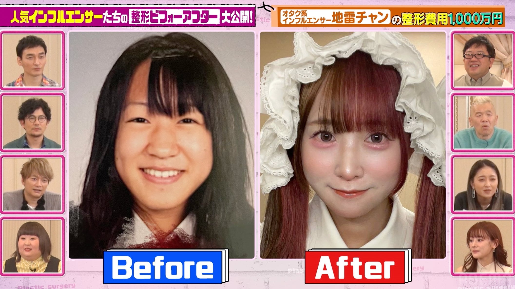【写真・画像】小5で二重に…整形総額1000万円インフルエンサー、元の顔に稲垣吾郎が本音ポロリ「元々すごく…」 1枚目 | バラエティ ...