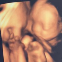 しょうくん『4D〜 ECHO〜』