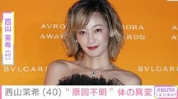 西山茉希（40）、“原因不明”体の異変を明かし写真を公開「過去一ひどかった」