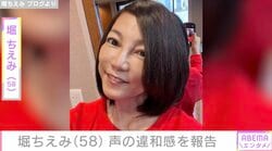 舌の半分以上を切除…堀ちえみ、舌がん完治も“声のカサつき”に不安「少しだけ悪血がついておりました」
