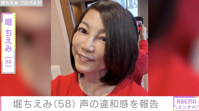 【写真・画像】2024年に舌がん完治・堀ちえみ(58) 声の違和感を報告「つや感がなくなりカサつきっぽい」　1枚目