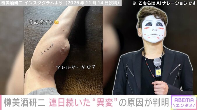 「体が悲鳴を…」樽美酒研二（44）、連日続いた“異変” まさかの原因が判明「全く気にもしてませんでした」 2枚目