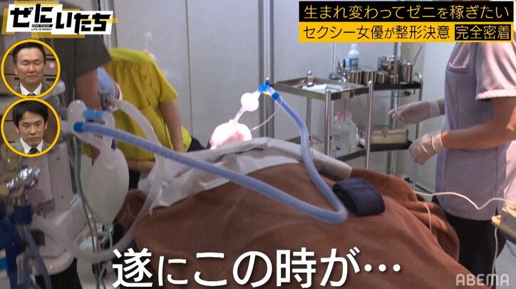 顔面フル整形したセクシー女優の6時間の手術に密着「目が開かない」ダウンタイムの苦痛もリポート