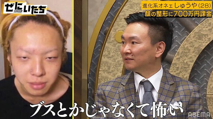 整形に700万課金、衝撃のビフォーアフター写真にかまいたち濱家「俺もああなれんのか」