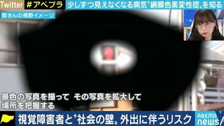 少しずつ奪われる視力、視野…“見えることが前提の社会”で悩む5万人の網膜色素変性症患者たち