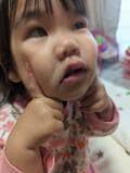 チェリー吉武、顔を強打して唇が腫れた娘「パワフルに全力で遊んでます」