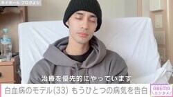 白血病のモデル・ネイボール（33）、他の病気も一緒に診断されていた「食生活見直したいと思います」