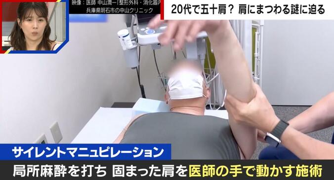 【写真・画像】20代で五十肩に？老化が原因では無かった？医師「なぜ起きるか全くの謎」「原因がわかればノーベル賞級」 肩にまつわる謎に迫る　4枚目