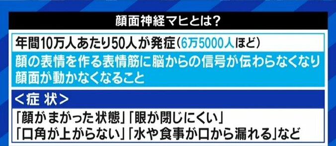 「自分の顔が自分の顔じゃなくなってしまう感じが残った」ジャスティン・ビーバーも罹患した“ラムゼイ・ハント症候群”、発症のピークは20代と50代に 5枚目