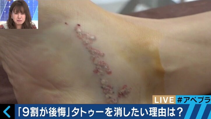 日本の実態は世界の非常識!?タトゥー・刺青は医療行為なのか 　元山口組幹部の沖田臥竜氏「やりすぎたなと思う」