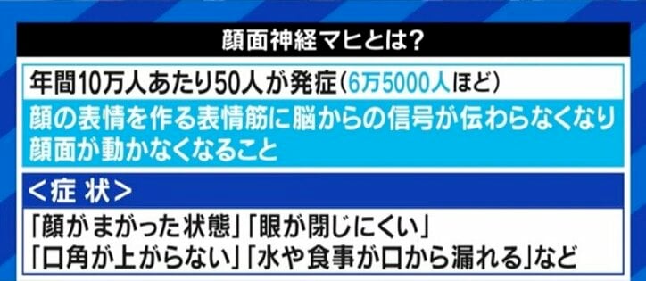 「自分の顔が自分の顔じゃなくなってしまう感じが残った」ジャスティン・ビーバーも罹患した“ラムゼイ・ハント症候群”、発症のピークは20代と50代に