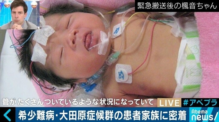 日本に100人未満…希少難病「大田原症候群」患者母子に密着