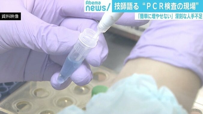 出産後2カ月で復帰余儀なく…技師語るPCR検査の現場「すぐに検査数増やせない」 1枚目