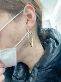 高橋真麻『顎関節症』