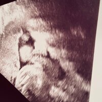 小泉貴之『ここにきて戸惑っていること』