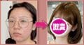 「元乃木坂46与田祐希似」と話題・ニキビ顔→肌治療＆メイク術でアイドルになった美女、ビフォーアフターに驚きの声