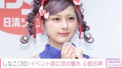 しなこ（30）、「閲覧注意」目元や唇が腫れた姿を公開し心配の声「休んで欲しい」「点滴までしたなんてつらかったよね」