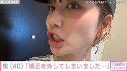 4度目の歯列矯正・桃（40）、約1週間でワイヤー器具を外す「私を根性なしと呼んでくれ…」