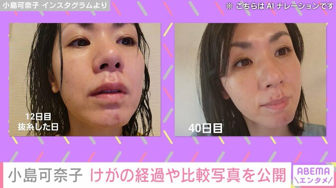 けがから12日目と40日目の比較写真