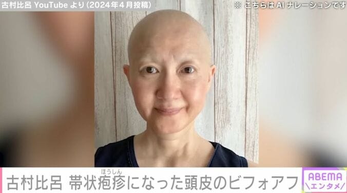 古村比呂