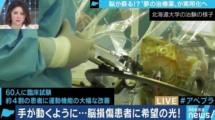 脳損傷患者に希望の光？サンバイオ森敬太社長が語る「SB623」の期待と課題