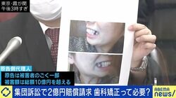 高額報酬で実質無料を謳う歯科矯正が裁判トラブルに 歯科医師「バカにされた。許せない」「医療から美容に足を踏み入れている」