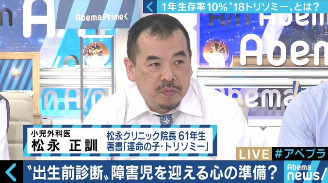 “1年以上の生存率は10％”…18トリソミー児の家族たちが写真展に託した苦悩と葛藤 5枚目