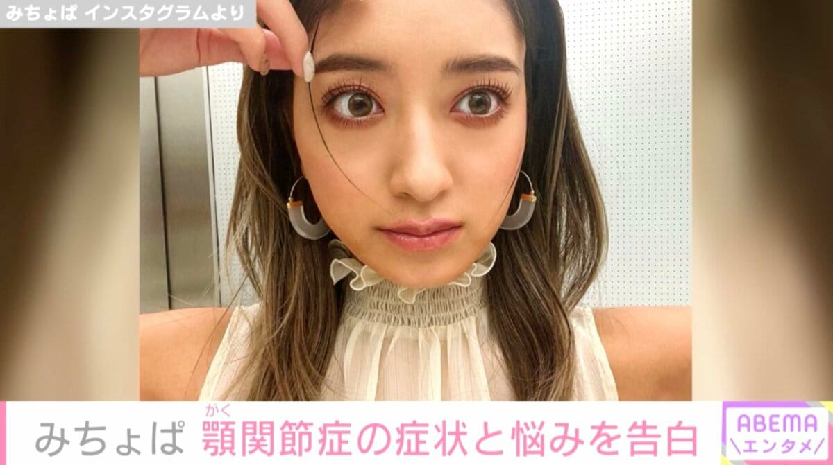 顎 関節 症 芸能人