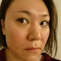 フォーリンラブ『肌を焼く【6日後】』