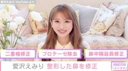 元歌舞伎町ナンバー1キャバ嬢・愛沢えみり、整形した鼻を“修正” 5年前とのビフォーアフターに「優しい顔になった」の声